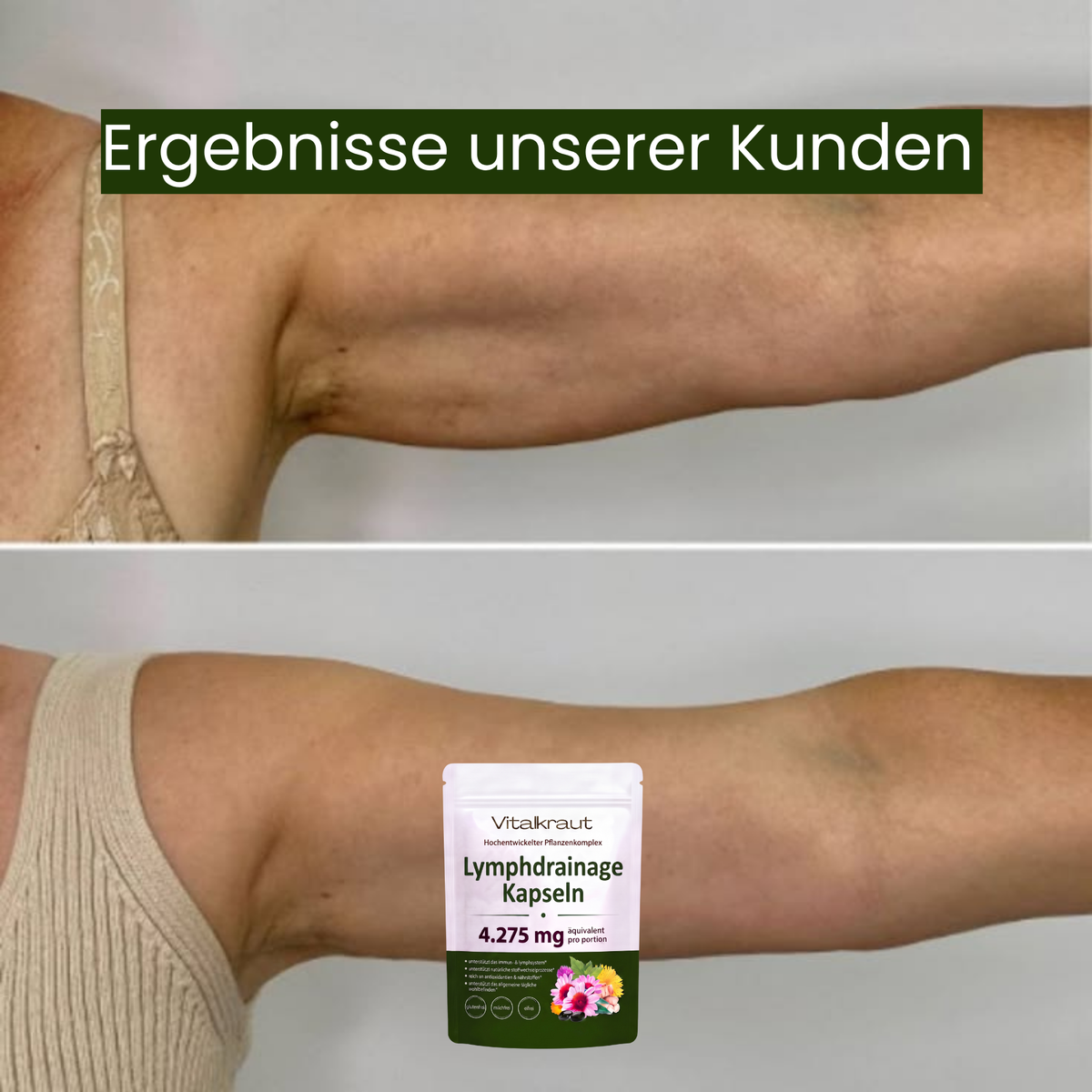 Schwarze Softgell Kapseln