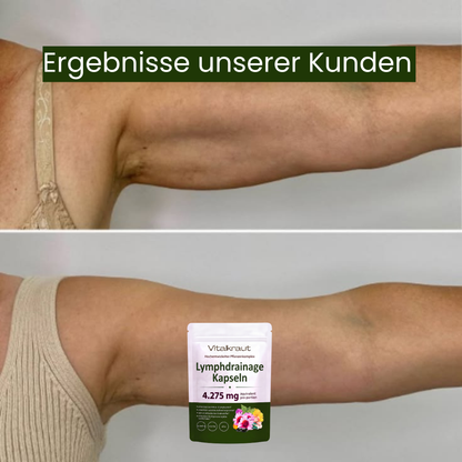 Schwarze Softgell Kapseln