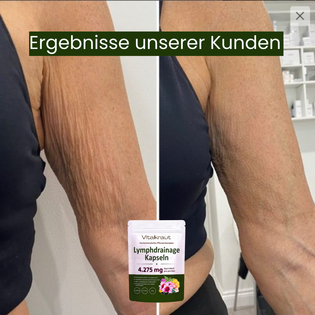Schwarze Softgell Kapseln